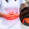 Ramalan Zodiak Aries Jum'at 23 Desember 2022: Kamu Mulai Menderita Penyakit Lambung, Segera ke Dokter
